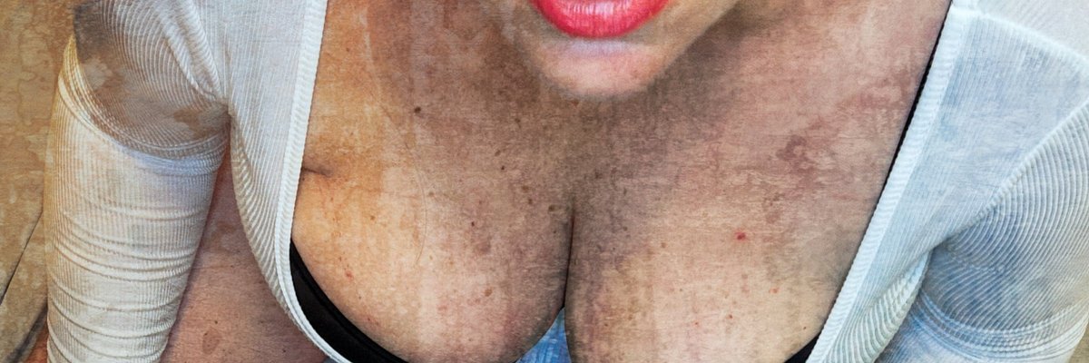 Tig Bitties cover