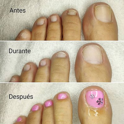 FanyFeet