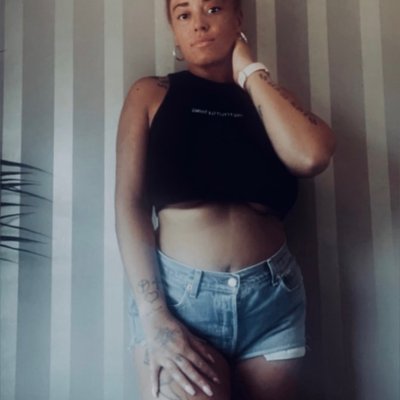 Freckle Babe xo