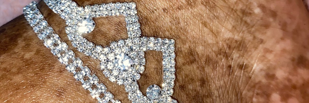 Freckled Rose🌹🤎🖤 cover