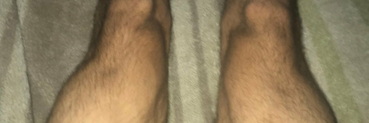 🦵🏻🦶🏻VIDEOCALL🦵🏻🦶🏻 cover