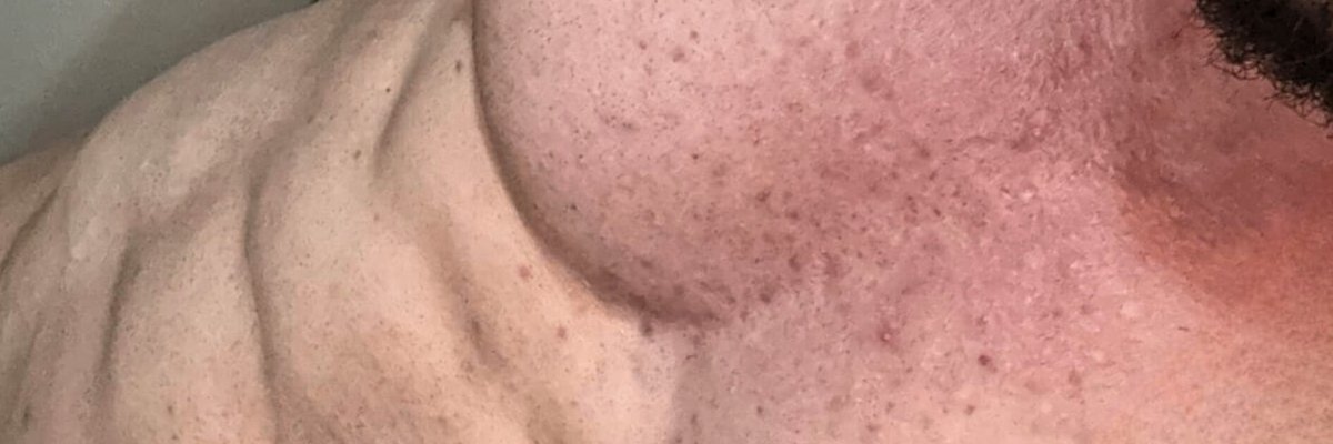 🔥 𝗦𝘁𝗿𝗮𝗶𝗴𝗵𝘁 𝗠𝗮𝘀𝗸𝗲𝗱🔥 cover