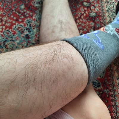 HairyFairy