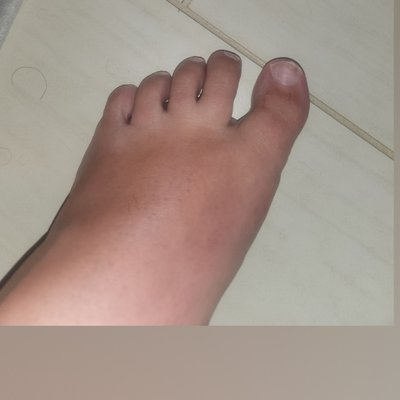 Stacy's ugly feet