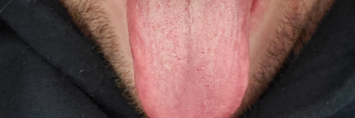 Tonguelashlover89 cover