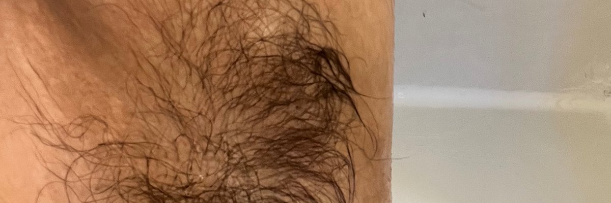 TheForeskinFreak cover