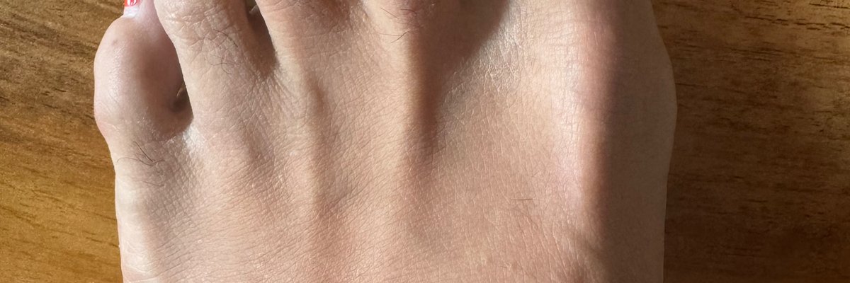 Toe Beautician cover