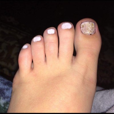 ToesBeforeBros99