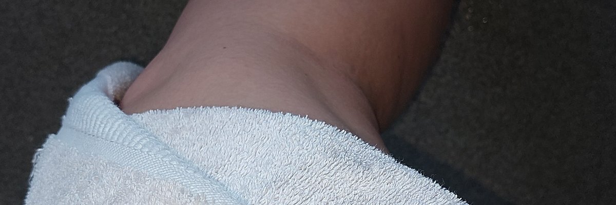 Legs of a queen cover