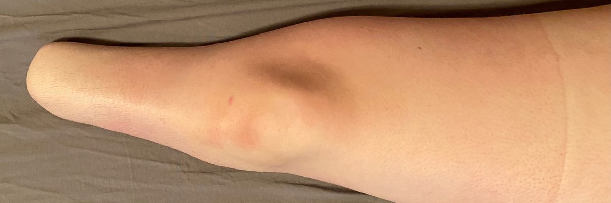 1 Nub Gets Loved cover