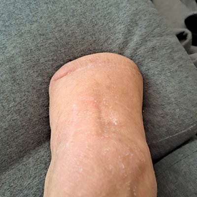 Amputee fetish fun