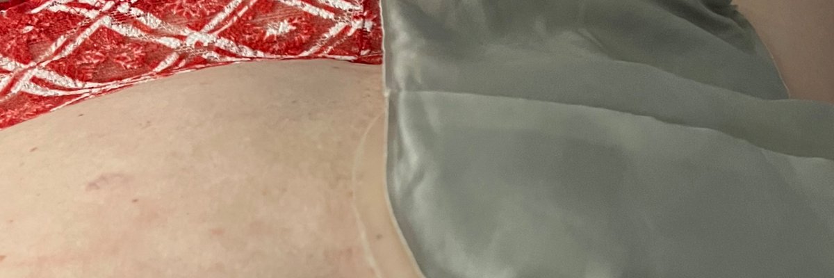 Ostomy Hot Mama cover